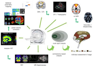 Simultaneous PET/MRI: The future gold standard for characterizing motor neuron disease—A clinico-radiological and neuroscientific perspective